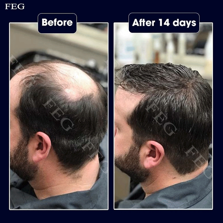 FEG PLUS Hair Spray – 100% Original, Money Back Guarantee